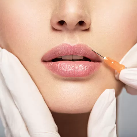 Relleno de labios con ácido hialurónico