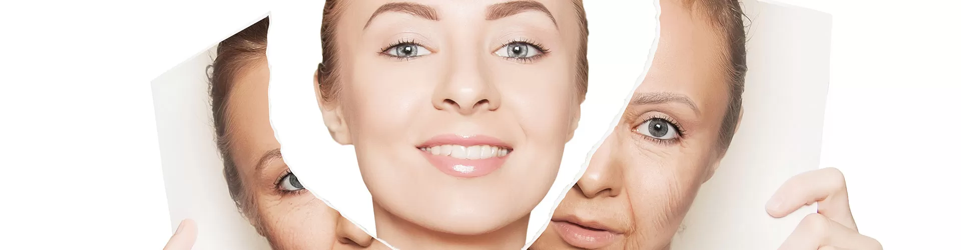 FRACULA Treatment