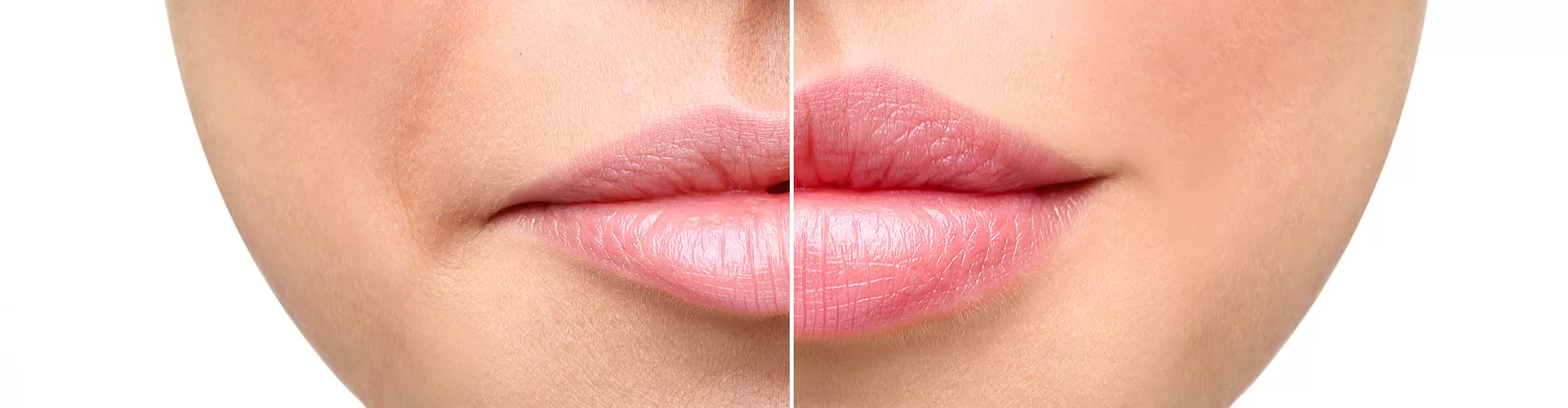 Russian Lips – técnica rusa